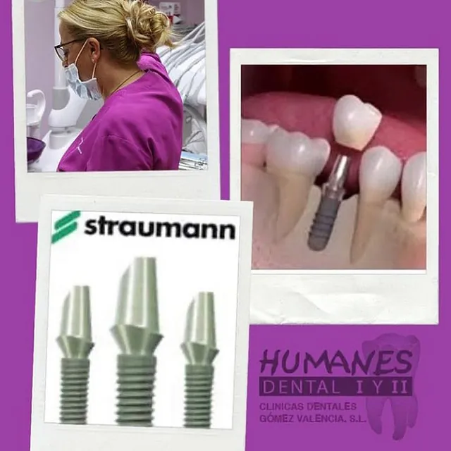 Humanes Dental implantes dentales