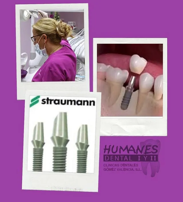 Humanes Dental variedad de implantes 